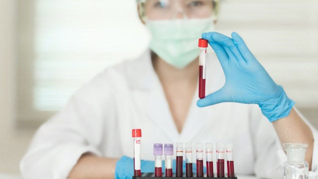 Nhóm máu của bạn có thể dự báo cho một số vấn đề về trí nhớ. Ảnh: Shutterstock Nhóm máu của bạn có thể dự báo cho một số vấn đề về trí nhớ. Ảnh: Shutterstock