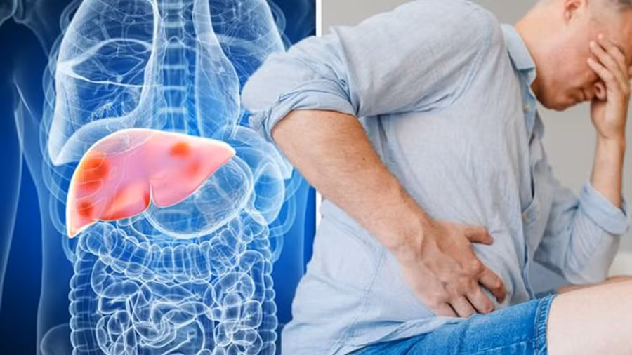 Khi các triệu chứng xuất hiện là lúc gan đã bị sẹo do tổn thương, hay còn gọi là xơ gan. Ảnh: Shutterstock