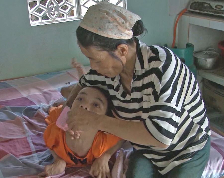 2. Con bị nhiễm độc da cam nên mọi công việc đều do vợ chồng ông Lê Tấn Dũng làm thay