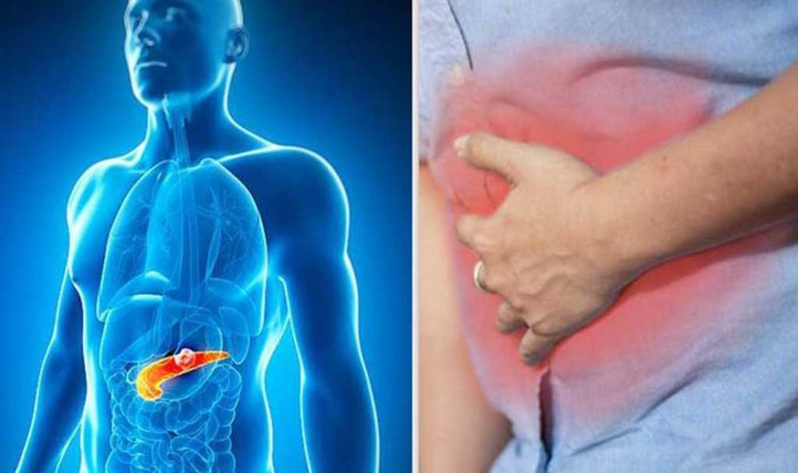 Khoảng 20% trường hợp ung thư tuyến tụy là do hút thuốc. Ảnh: Shutterstock Khoảng 20% trường hợp ung thư tuyến tụy là do hút thuốc. Ảnh: Shutterstock