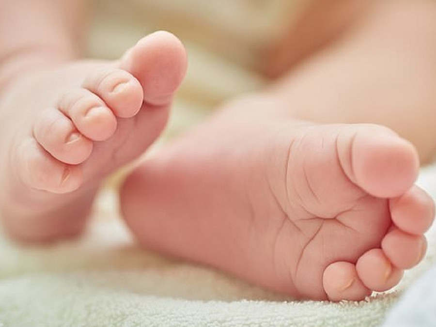 Sợi tóc quấn quanh ngón chân đã khiến ngón chân bé Logan bị sưng và chuyển sang màu tím. Minh họa: SHUTTERSTOCK Sợi tóc quấn quanh ngón chân đã khiến ngón chân bé Logan bị sưng và chuyển sang màu tím. Minh họa: SHUTTERSTOCK