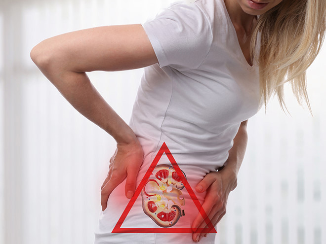 Mất nước là một trong những nguyên nhân chính gây sỏi thận, vì thế uống nước có thể giúp ngăn ngừa sự xuất hiện của chúng - Ảnh minh họa: Shutterstock