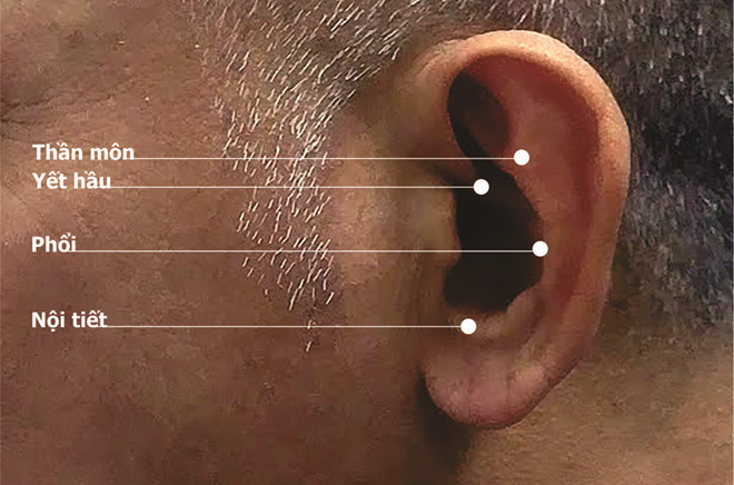 Vị trí nhĩ châm cai thuốc lá - Ảnh: Nam Sơn