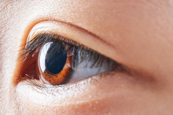 MiSight được chỉ định cho trẻ 8 - 12 tuổi, giúp làm chậm tiến triển cận thị