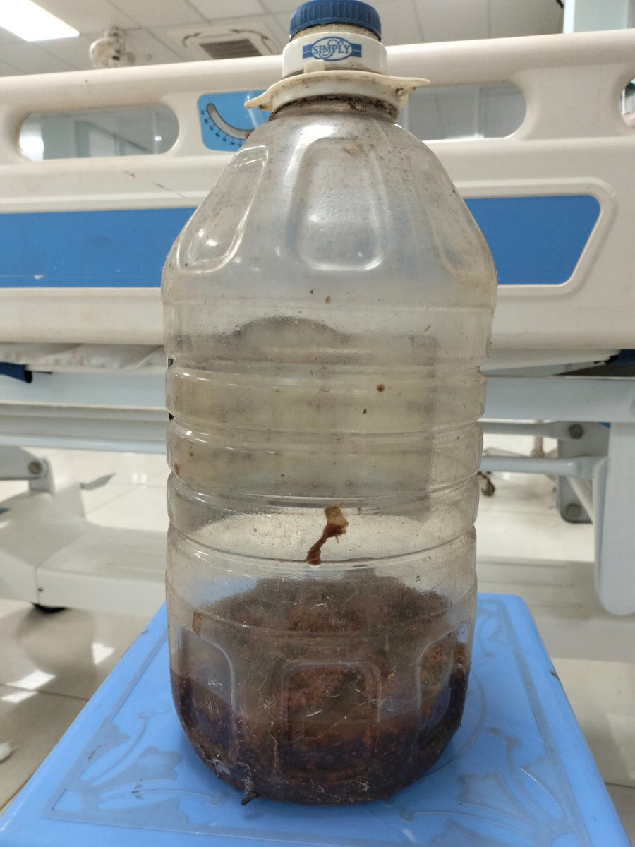 Bình rượu ngâm quả cà có gai mà các bệnh nhân đã uống trước khi có biểu hiện ngộ độc Ảnh: Thế Hùng