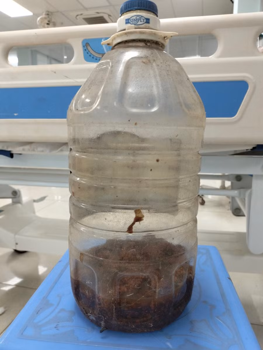 Bình rượu ngâm quả cà có gai mà các bệnh nhân đã uống trước khi có biểu hiện ngộ độc Ảnh: Thế Hùng