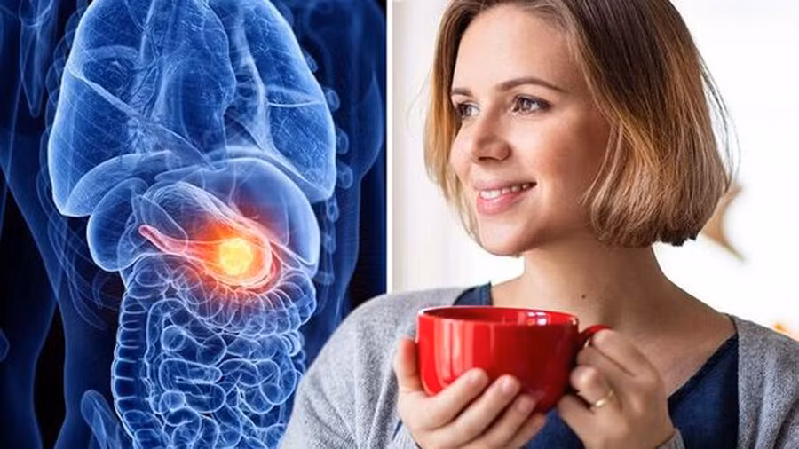 Một chuyên gia cho biết trà bồ công anh là cách đơn giản có thể làm để giảm nguy cơ ung thư. Ảnh: Shutterstock