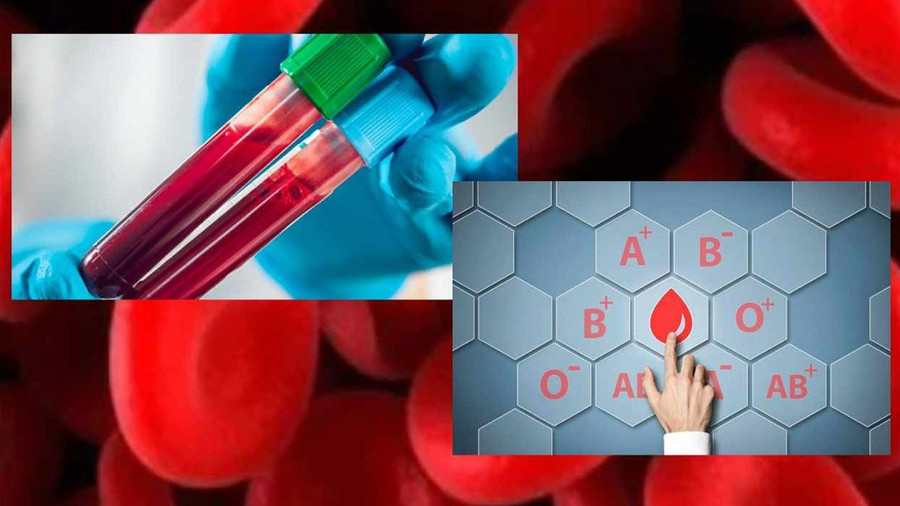 Nhóm máu cũng ảnh hưởng đến sự phát triển của huyết áp cao. Ảnh: Shutterstock