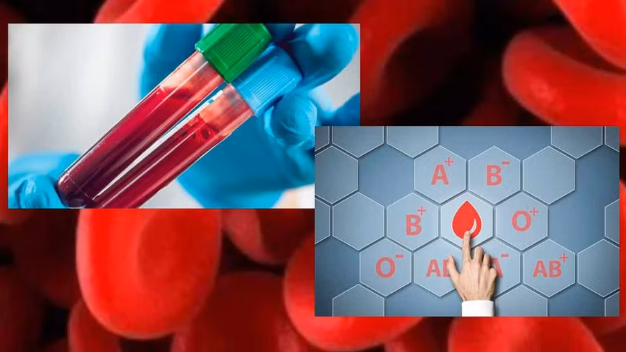 Nhóm máu cũng ảnh hưởng đến sự phát triển của huyết áp cao. Ảnh: Shutterstock