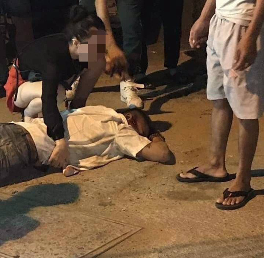 Tài xế xe taxi bị thương nặng sau khi bị hành hung - Ảnh: OFFB