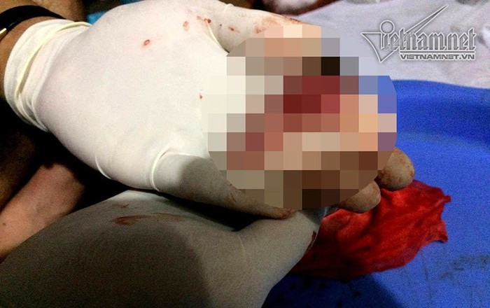 Chàng sinh viên 2 năm đi nhặt 3.000 xác thai nhi ảnh 2 Chàng sinh viên 2 năm đi nhặt 3.000 xác thai nhi