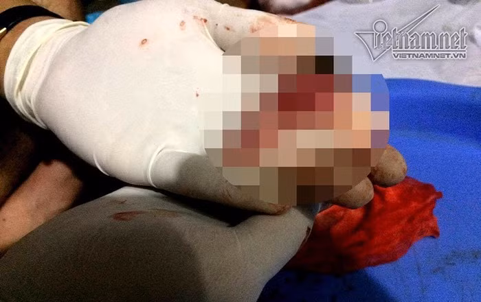 Chàng sinh viên 2 năm đi nhặt 3.000 xác thai nhi