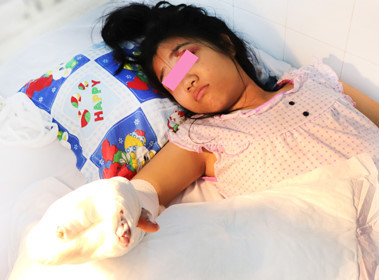 Các bác sĩ chỉ giữ được 4 ngón trên bàn tay của bé