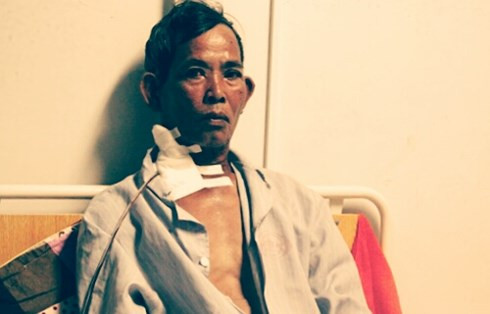  Ông Nguyễn Tường bị đâm 4 nhát và đang nằm viện điều trị.