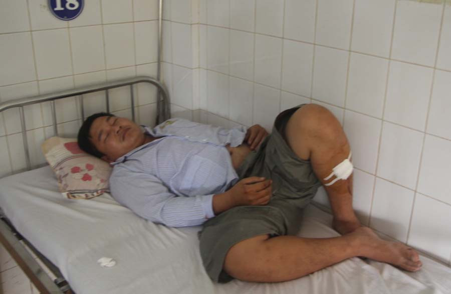 Đối tượng Đinh Văn Mạnh cũng đang được điều trị tại Bệnh viện Đa khoa tỉnh. Ảnh: Văn Ngọc