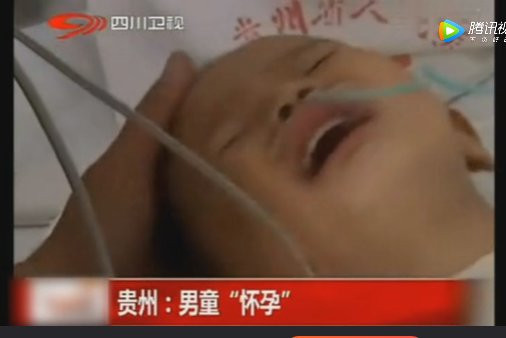 Trong bụng Khang Khang thật sự có một bào thai đang phát triển Trong bụng Khang Khang thật sự có một bào thai đang phát triển