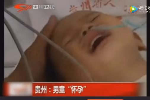 Trong bụng Khang Khang thật sự có một bào thai đang phát triển