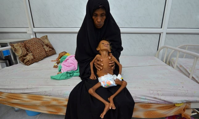 Một bà mẹ và con trai 6 tuổi người Yemen trong một bệnh viện tại thành phố cảng Hodeida. Ảnh: Reuters Một bà mẹ và con trai 6 tuổi người Yemen trong một bệnh viện tại thành phố cảng Hodeida. Ảnh: Reuters