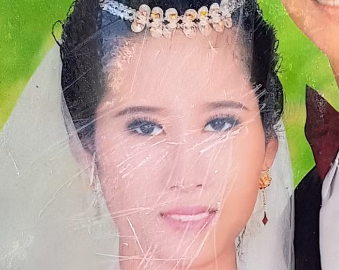  Ảnh của Nguyễn Thị Thảo bị mẹ chồng dùng vật cứng cắt nát. Ảnh gia đình cung cấp.