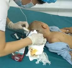 Ảnh minh họa (nguồn internet) Ảnh minh họa (nguồn internet)