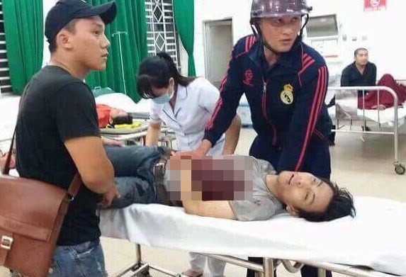 Một nạn nhân lúc cấp cứu ở Bệnh viện đa khoa Long Thành.