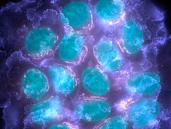 (Nguồn: abc.net.au)