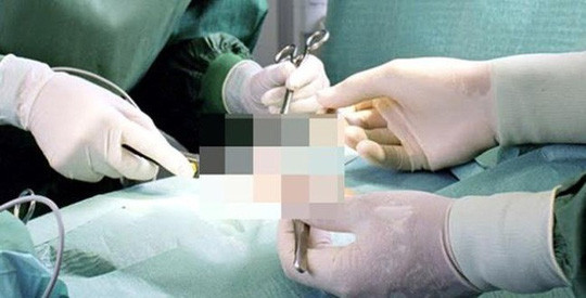 Một ca phẫu thuật nối ghép dương vật - Ảnh minh họa