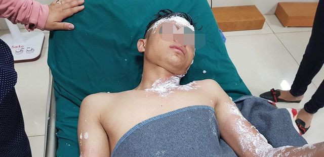 Nhiều người bị bỏng nặng, có trường hợp nguy cơ mù vĩnh viễn.