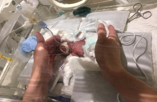 Em bé Nhật Bản nhỏ như củ hành, lọt thỏm giữa bàn tay người lớn. Ảnh: Keio University School of Medicine. Em bé Nhật Bản nhỏ như củ hành, lọt thỏm giữa bàn tay người lớn. Ảnh: Keio University School of Medicine.