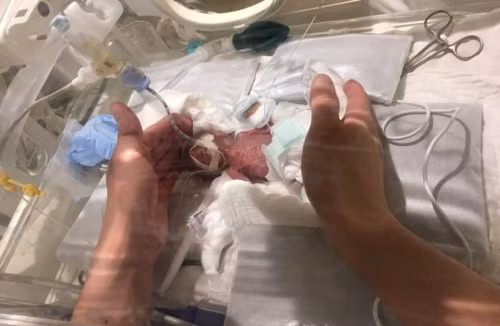 Em bé Nhật Bản nhỏ như củ hành, lọt thỏm giữa bàn tay người lớn. Ảnh: Keio University School of Medicine.