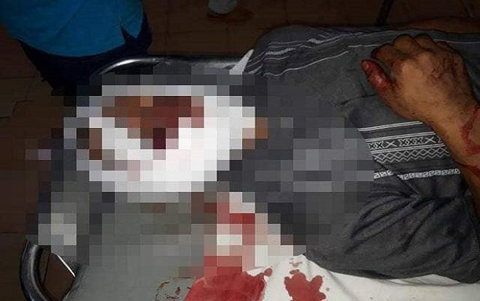 Đặng Dầu Chìu bị thương đang được điều trị tại bệnh viện. Đặng Dầu Chìu bị thương đang được điều trị tại bệnh viện.