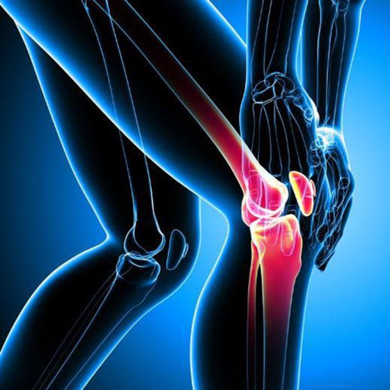 Tập luyện thể thao quá mức, không hợp lý dễ gây tổn thương sụn khớp và xương dưới sụn