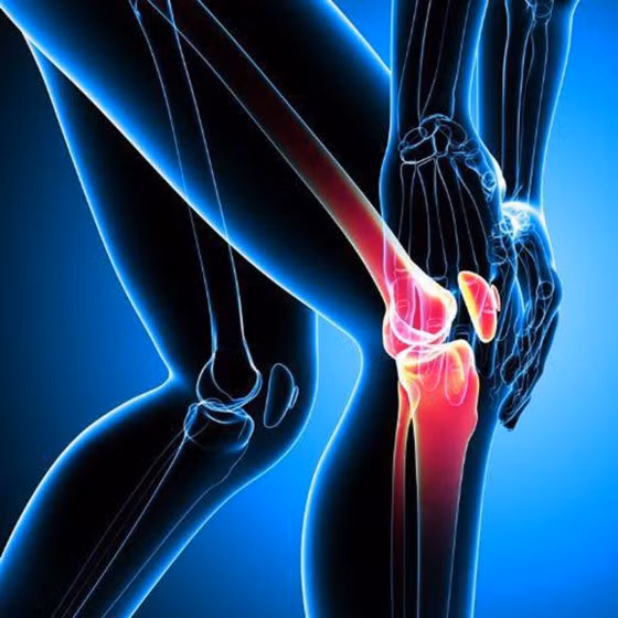 Tập luyện thể thao quá mức, không hợp lý dễ gây tổn thương sụn khớp và xương dưới sụn