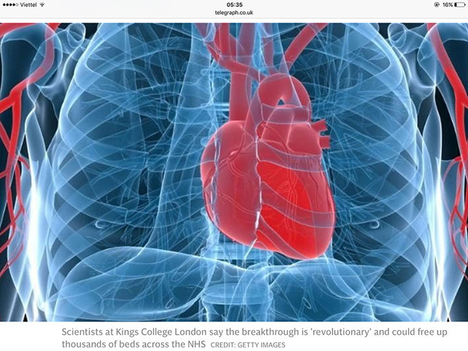 Các nhà nghiên cứu Anh đã thử nghiệm một xét nghiệm máu giúp bác sĩ thấy được rõ ràng các triệu chứng của nhồi máu cơ tim chỉ trong vòng 15 đến 30 phút. Các nhà nghiên cứu Anh đã thử nghiệm một xét nghiệm máu giúp bác sĩ thấy được rõ ràng các triệu chứng của nhồi máu cơ tim chỉ trong vòng 15 đến 30 phút.