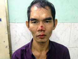  Lâm tại cơ quan điều tra. Ảnh: Quốc Thắng.