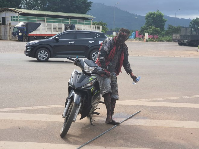 Một nạn nhân bị bỏng nặng sau sự cố cháy nổ ẢNH: THANH LỘC