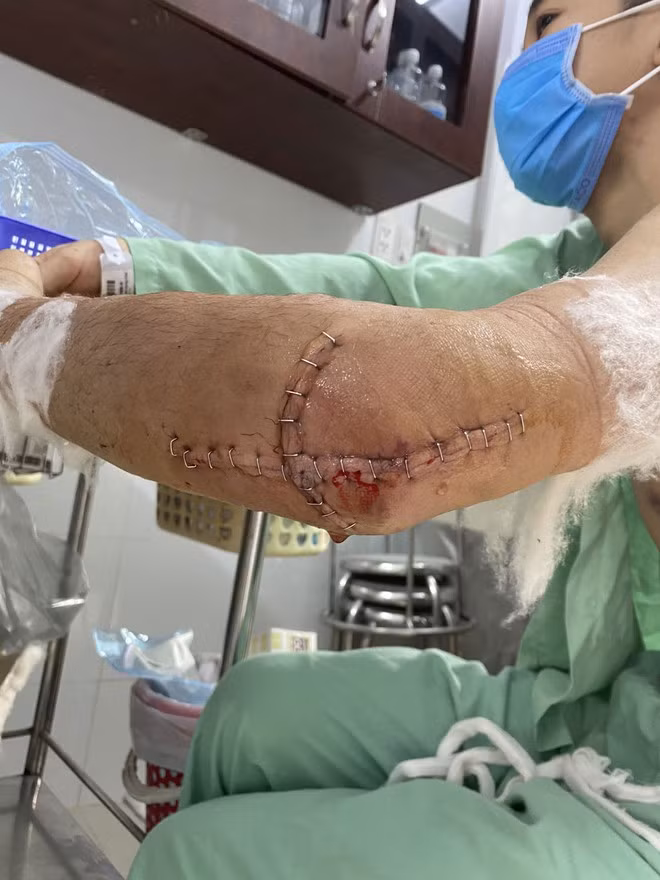 V. bị bạn đồng nghiệp chém tại tiệm sơn ẢNH: CẮT TỪ CLIP