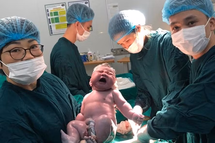 Ca sinh thành công, bé sơ sinh nặng 5.75kg. Ảnh: Thanh Đặng