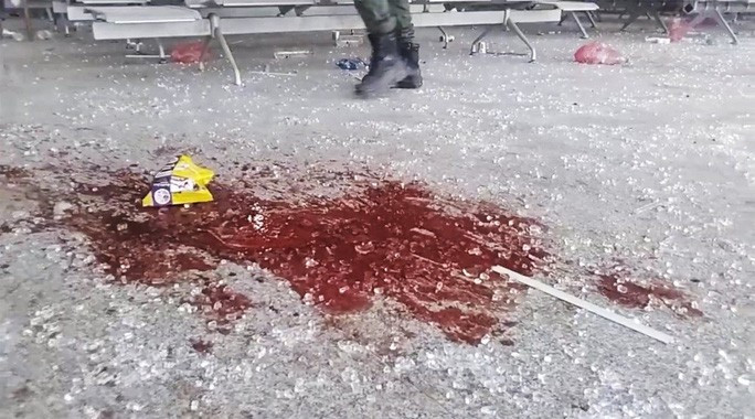 Vết máu loang lổ trên sàn sân bay. Ảnh: AP  Vết máu loang lổ trên sàn sân bay. Ảnh: AP