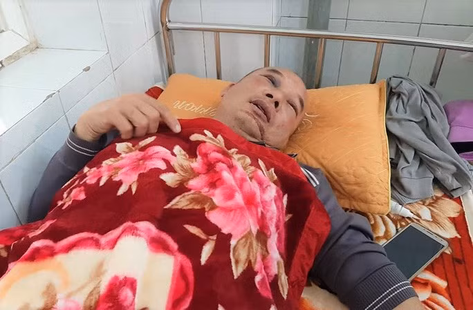 Vết thương ở cằm ông Chung do bị siết cổ