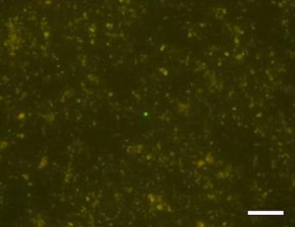 Hình ảnh trên kính hiển vi cho thấy các vi sinh vật bí ẩn trong lõi trầm tích - Ảnh: JAMSTEC/IODP