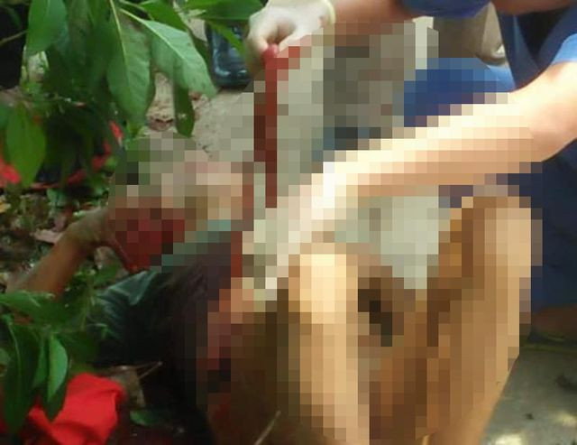  Ông L. được sơ cứu trước khi đưa vào viện cấp cứu.