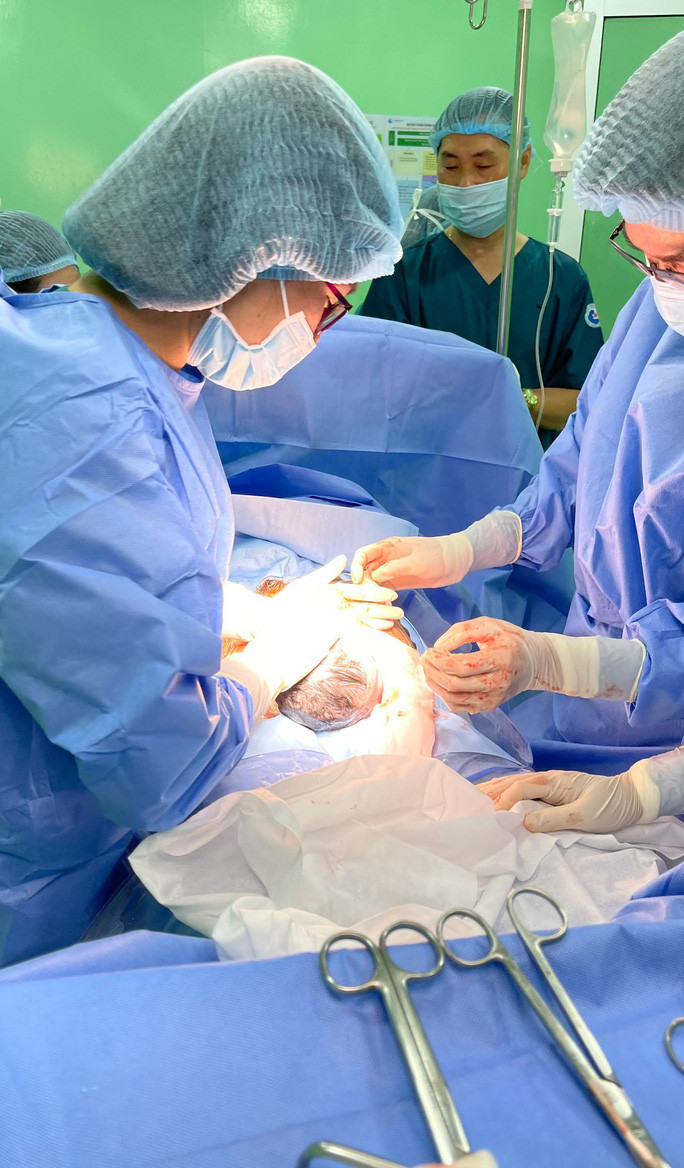  Bức ảnh bác sĩ Bùi Văn Hoàng chia sẻ với báo giới, do đồng nghiệp của anh chụp được đúng 0 giờ, khi đầu bé sơ sinh ló ra khỏi bụng mẹ - Ảnh: BỆNH VIỆN TỪ DŨ