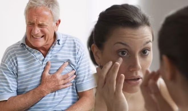 Mắt có thể chỉ ra nguy cơ của cơn đau tim. ẢNH: SHUTTERSTOCK