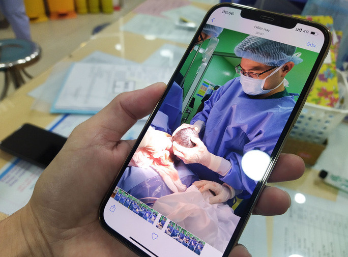  Một bức ảnh khác hiển thị 0 giờ 1 giây, khi thân mình em bé đang dần được đưa ra khỏi cơ thể mẹ