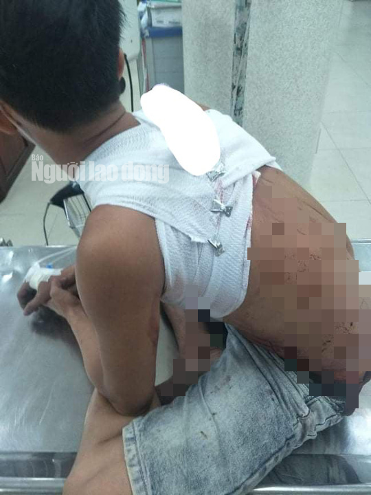 Kiểng mang con dao đâm lút cán vào bệnh viện Kiểng mang con dao đầm lút cán vào bệnh viện