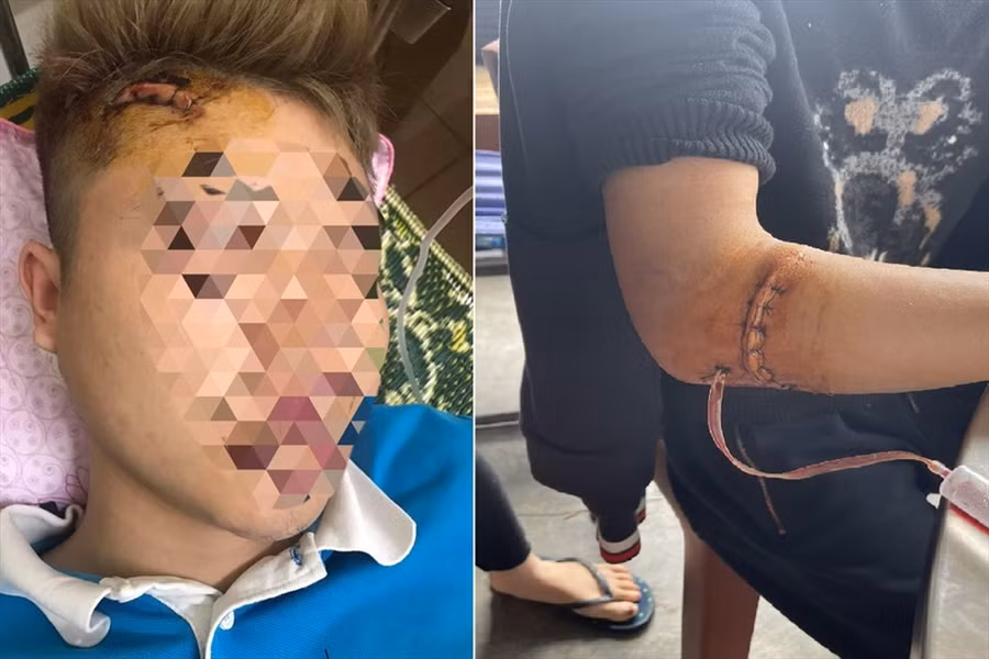 2 người bị chém thương tích ở đầu và tay. Ảnh: DC.