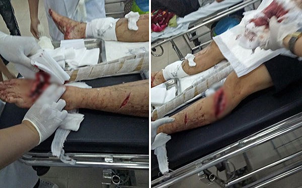 Ảnh minh họa Ảnh minh họa