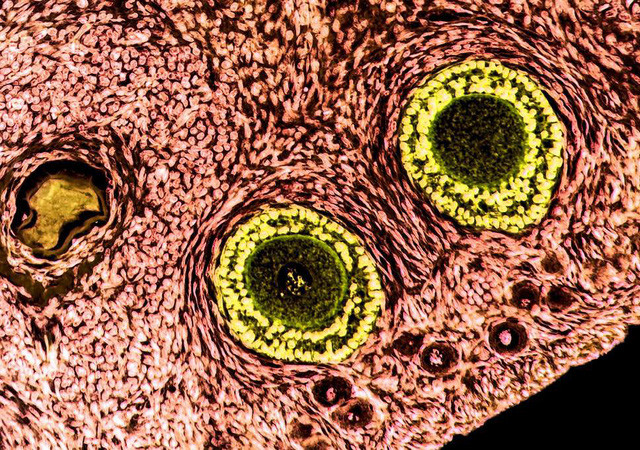 Các nhà khoa học tin rằng, phương pháp này hoàn toàn có thể áp dụng trên cơ thể người trong tương lai không xa - Ảnh: Getty iStock Các nhà khoa học tin rằng, phương pháp này hoàn toàn có thể áp dụng trên cơ thể người trong tương lai không xa - Ảnh: Getty iStock