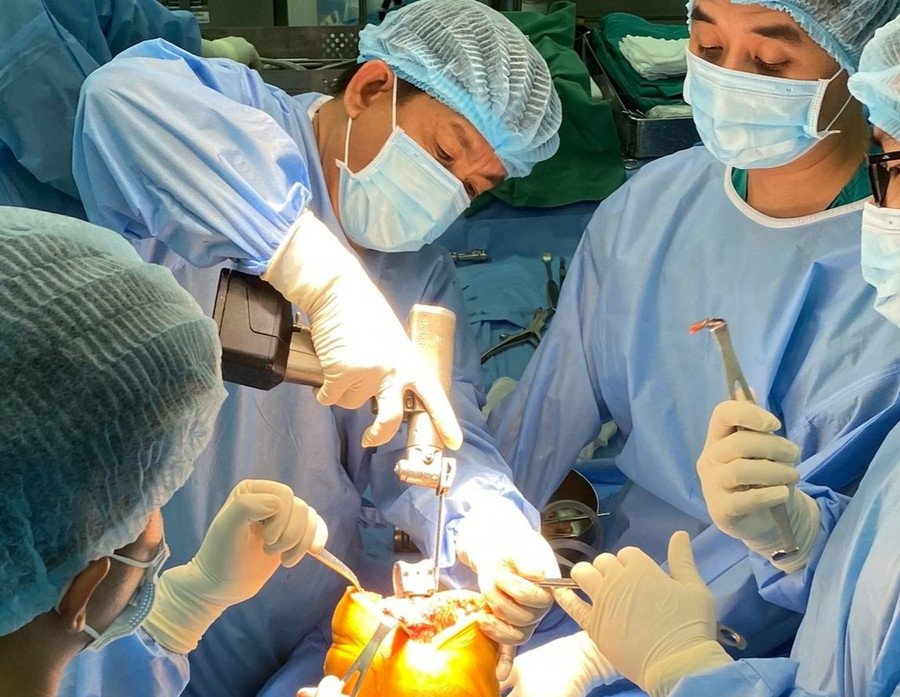 Các bác sĩ phẫu thuật thay khớp gối cho bệnh nhân. ẢNH: BVCC